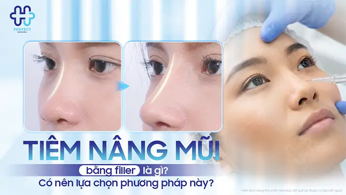 Tiêm nâng mũi bằng filler là gì? Có nên lựa chọn phương pháp này?