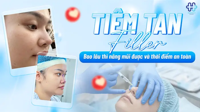 Tiêm Tan Filler Bao Lâu Thì Nâng Mũi Được Và Thời Điểm An Toàn