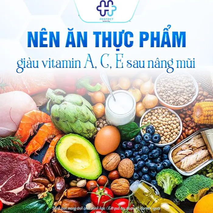 Trước Khi Nâng Mũi Nên Ăn Gì? Những Lưu Ý Trước Khi Nâng Mũi