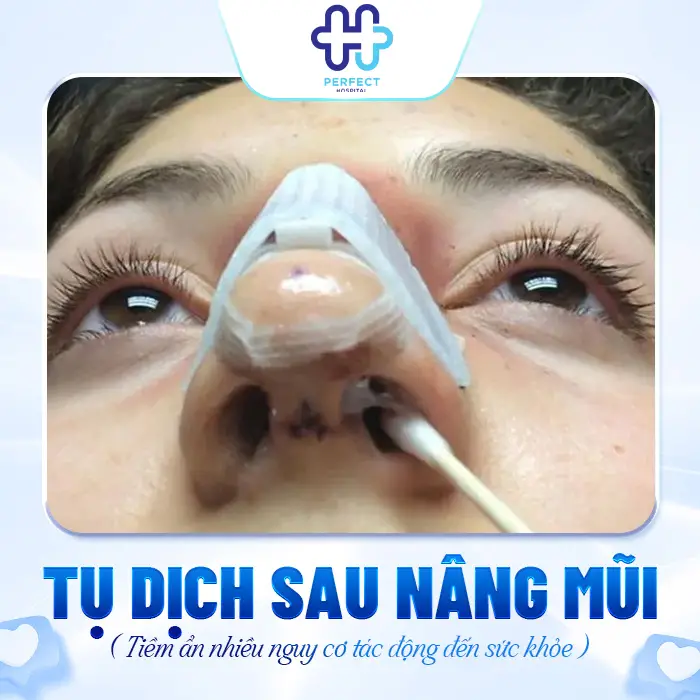 Tụ Dịch Sau Nâng Mũi Có Nguy Hiểm Không? Cách Xử Lý An Toàn
