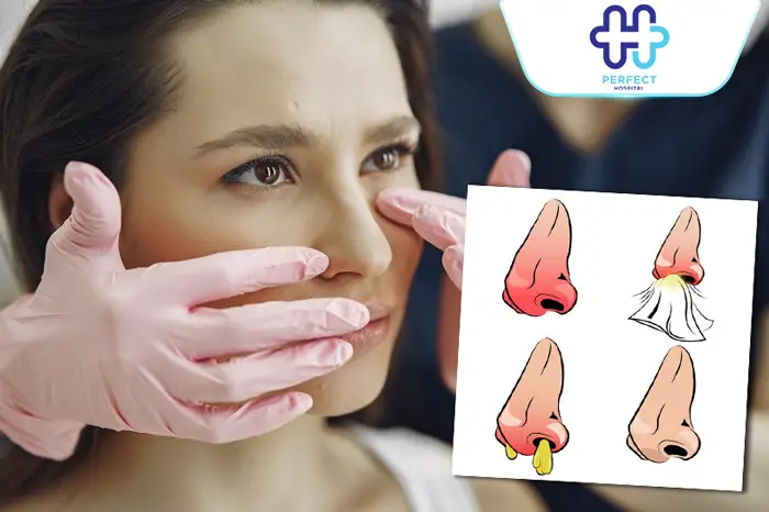 Tụ Dịch Sau Nâng Mũi Có Nguy Hiểm Không? Cách Xử Lý An Toàn