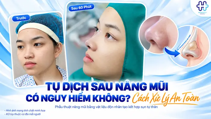 Tụ Dịch Sau Nâng Mũi Có Nguy Hiểm Không? Cách Xử Lý An Toàn