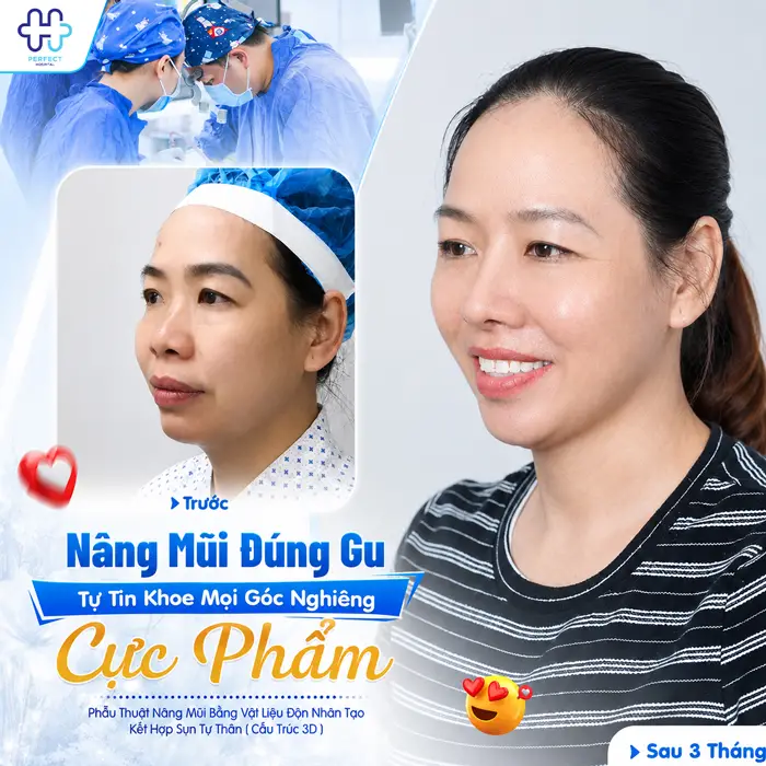 50 Tuổi Có Nên Nâng Mũi Không? Góc Nhìn Từ Chuyên Gia Thẩm Mỹ