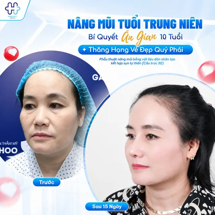 50 Tuổi Có Nên Nâng Mũi Không? Góc Nhìn Từ Chuyên Gia Thẩm Mỹ