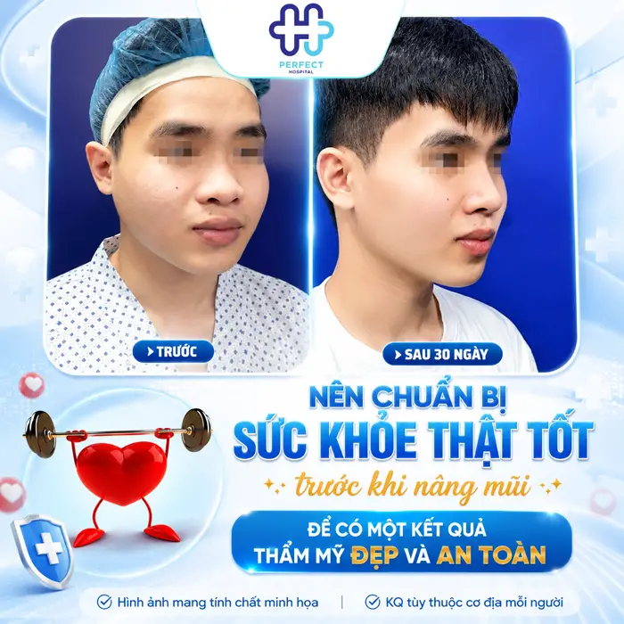 Bị Cảm Có Nâng Mũi Được Không? Khi Nào Nên Trì Hoãn Phẫu Thuật