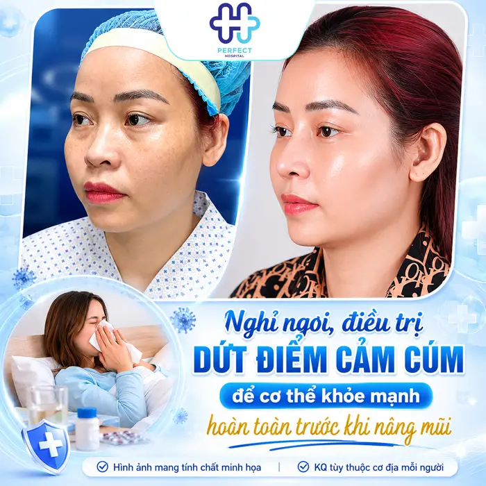 Bị Cảm Có Nâng Mũi Được Không? Khi Nào Nên Trì Hoãn Phẫu Thuật