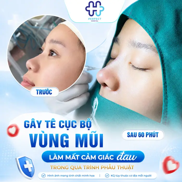 Các Phương Pháp Giảm Đau Trong Nâng Mũi Hiệu Quả Nhất Hiện Nay