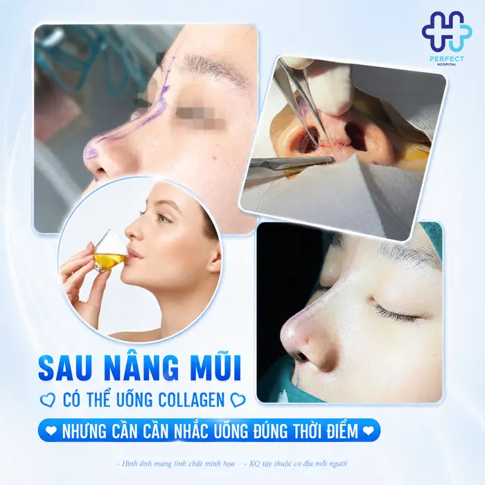 Có Được Uống Collagen Sau Khi Nâng Mũi Không? Có Gây Ảnh Hưởng Không?