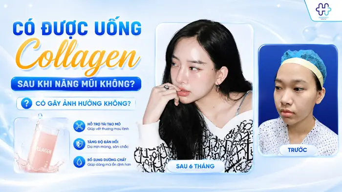 Có Được Uống Collagen Sau Khi Nâng Mũi Không? Có Gây Ảnh Hưởng Không?