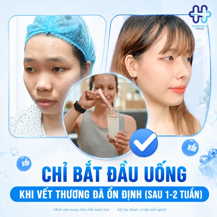 Có Được Uống Collagen Sau Khi Nâng Mũi Không? Có Gây Ảnh Hưởng Không?