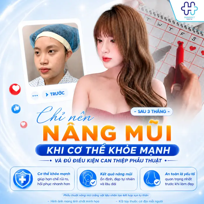 Có Kinh Có Nâng Mũi Được Không? Những Điều Cần Biết Trước Khi Phẫu Thuật