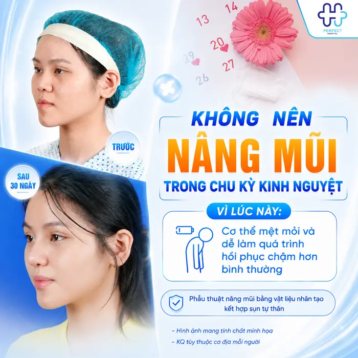 Có Kinh Có Nâng Mũi Được Không? Những Điều Cần Biết Trước Khi Phẫu Thuật