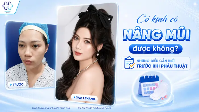 Có Kinh Có Nâng Mũi Được Không? Những Điều Cần Biết Trước Khi Phẫu Thuật
