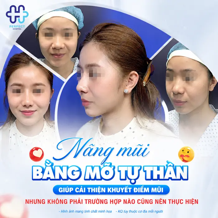 Có Nên Nâng Mũi Bằng Mỡ Tự Thân Không? Sự Thật Cần Biết