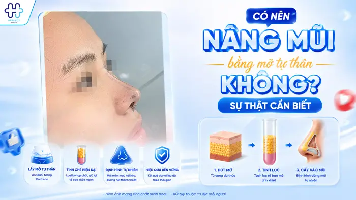 Có Nên Nâng Mũi Bằng Mỡ Tự Thân Không? Sự Thật Cần Biết