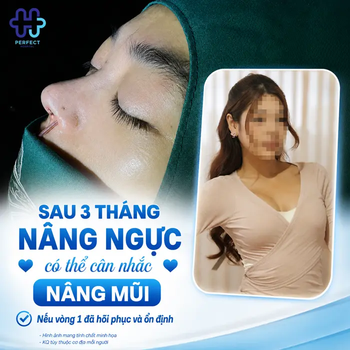 Có Nên Nâng Mũi Sau Khi Nâng Ngực Không? Giải Đáp Từ Chuyên Gia