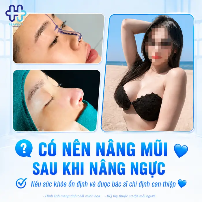 Có Nên Nâng Mũi Sau Khi Nâng Ngực Không? Giải Đáp Từ Chuyên Gia