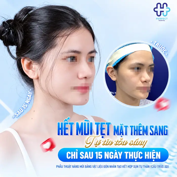 Mặt Hơi Dài Thì Nâng Mũi Dáng Nào Đẹp, Cân Đối Tự Nhiên?