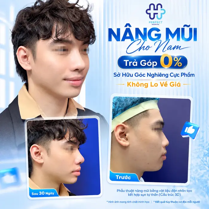 Mặt Hơi Dài Thì Nâng Mũi Dáng Nào Đẹp, Cân Đối Tự Nhiên?