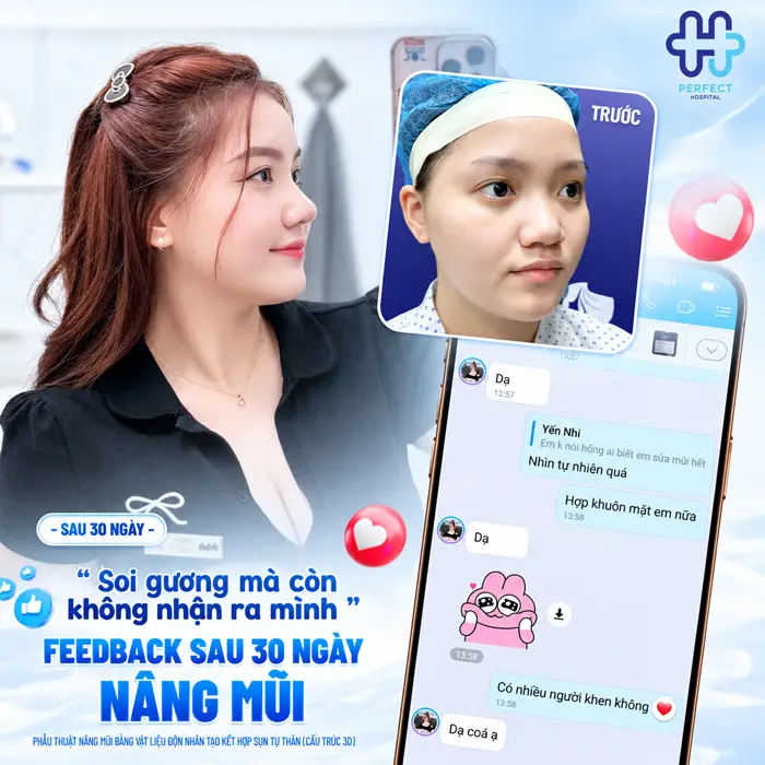 Mặt Trái Xoan Nâng Mũi Kiểu Nào Đẹp Tự Nhiên, Chuẩn Tỷ Lệ?