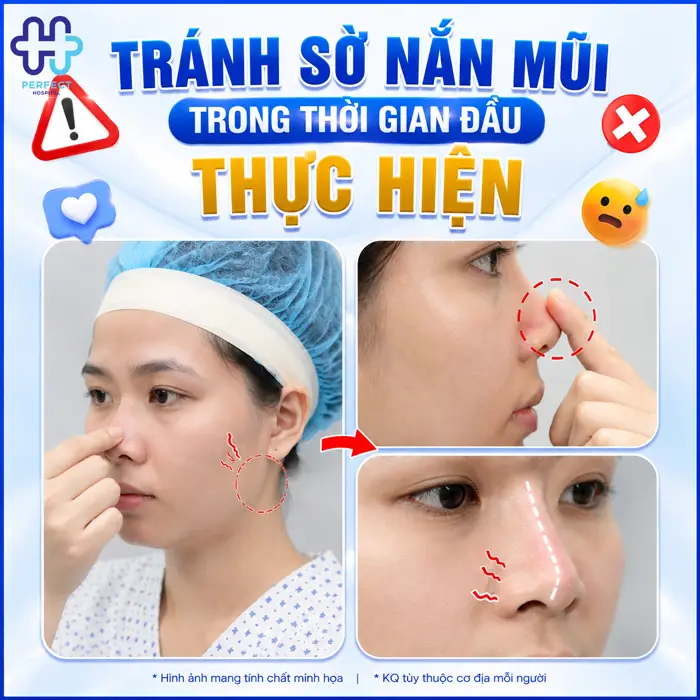 Mũi Bị Lung Lay Sau Nâng Mũi Có Sao Không? Nguyên Nhân & Cách Xử Lý