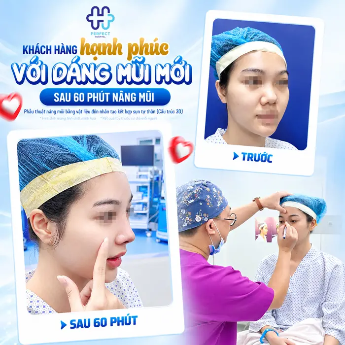 Mũi Tẹt Và Hếch Nên Nâng Kiểu Nào Để Đẹp Tự Nhiên, Hài Hòa?