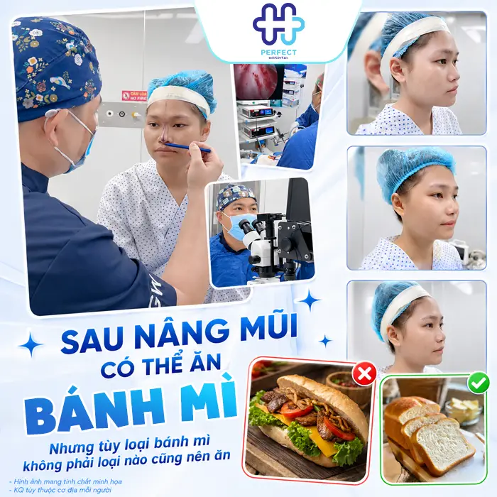 Nâng Mũi Có Được Ăn Bánh Mì Không? Chuyên Gia Giải Đáp Chi Tiết