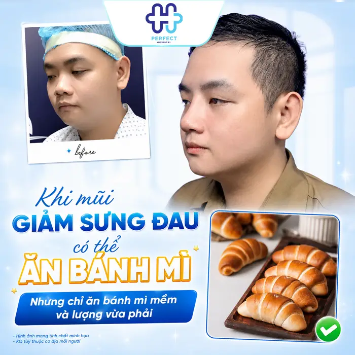 Nâng Mũi Có Được Ăn Bánh Mì Không? Chuyên Gia Giải Đáp Chi Tiết