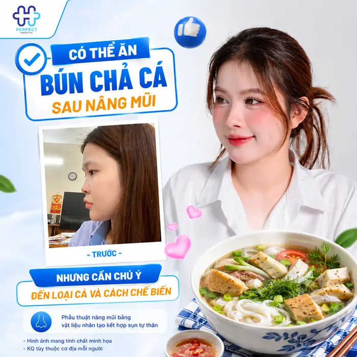 Nâng Mũi Ăn Bún Chả Cá Được Không? Bác Sĩ Giải Đáp Chi Tiết