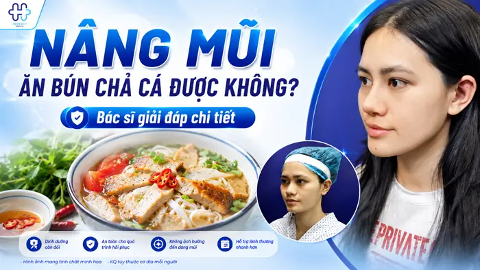 Nâng Mũi Ăn Bún Chả Cá Được Không? Bác Sĩ Giải Đáp Chi Tiết