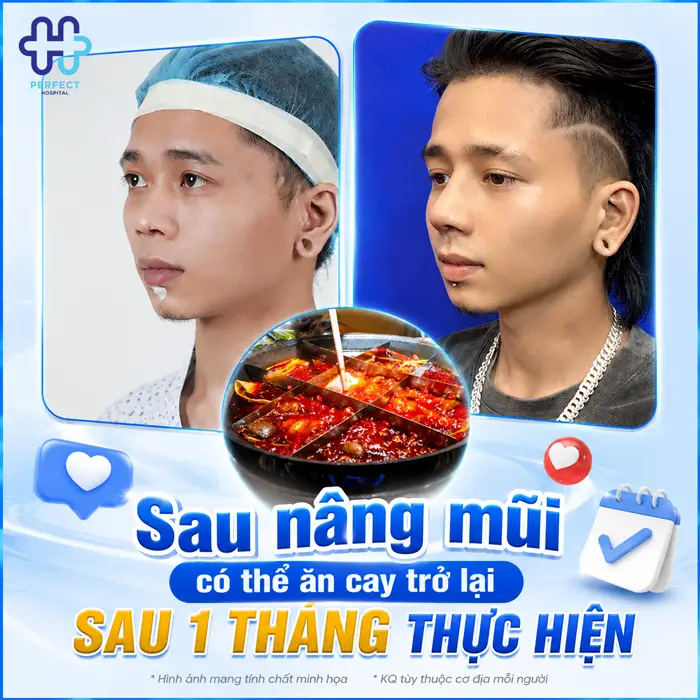 Nâng Mũi Ăn Cay Có Sao Không? Khi Nào Ăn Lại Được An Toàn