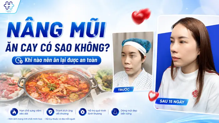 Nâng Mũi Ăn Cay Có Sao Không? Khi Nào Ăn Lại Được An Toàn