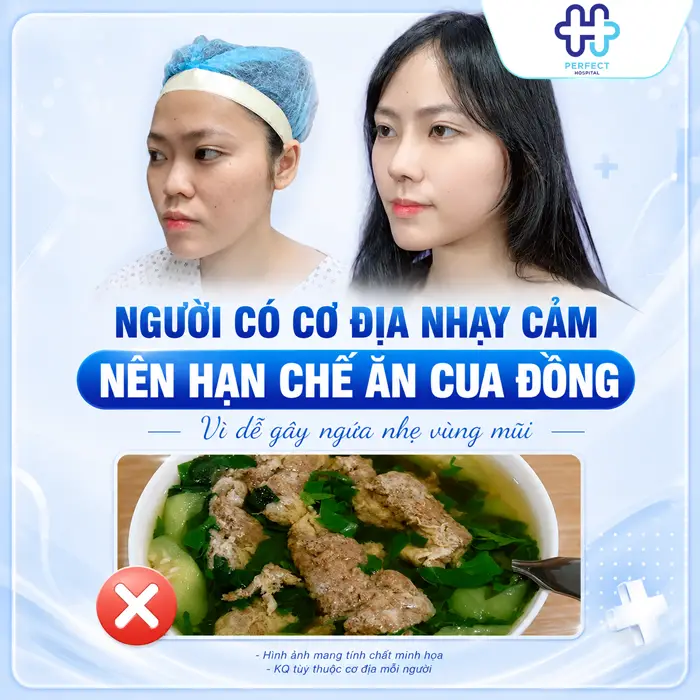 Nâng Mũi Ăn Cua Đồng Được Không? Chuyên Gia Giải Đáp Chi Tiết