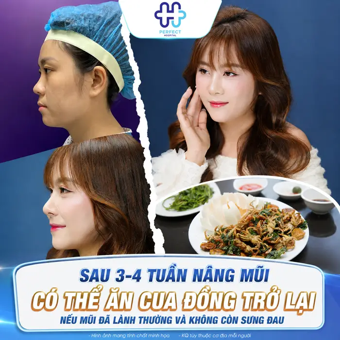 Nâng Mũi Ăn Cua Đồng Được Không? Chuyên Gia Giải Đáp Chi Tiết