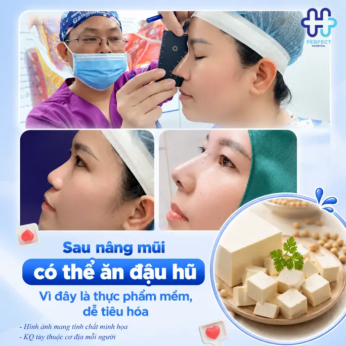 Nâng Mũi Ăn Đậu Hũ Được Không? Chuyên Gia Giải Đáp Chi Tiết