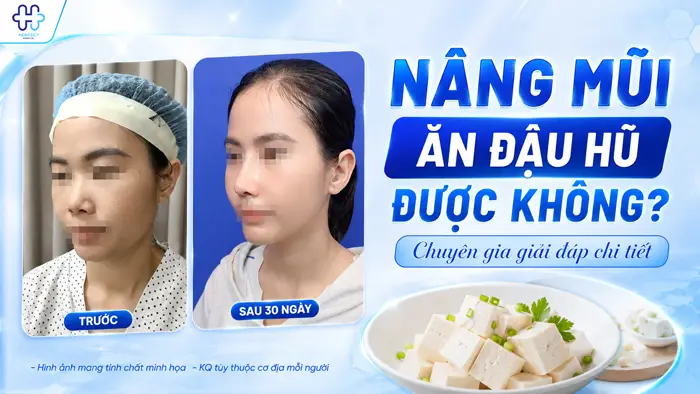 Nâng Mũi Ăn Đậu Hũ Được Không? Chuyên Gia Giải Đáp Chi Tiết