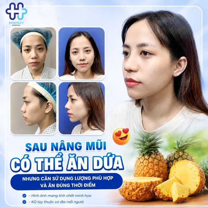 Nâng Mũi Ăn Dứa Được Không? Chuyên Gia Giải Đáp Chi Tiết