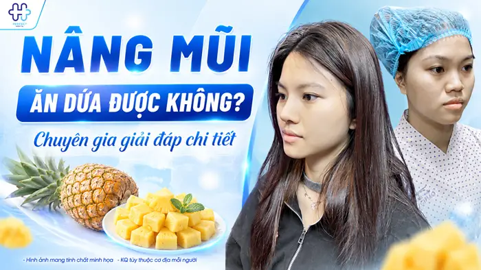 Nâng Mũi Ăn Dứa Được Không? Chuyên Gia Giải Đáp Chi Tiết