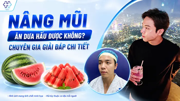 Nâng Mũi Ăn Dưa Hấu Được Không? Chuyên Gia Giải Đáp Chi Tiết