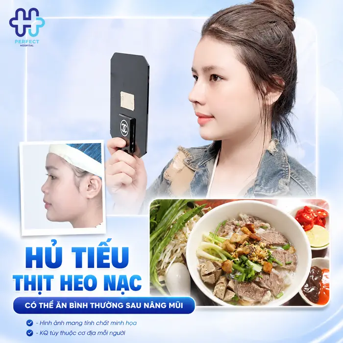 Nâng Mũi Ăn Hủ Tiếu Được Không? Cách Chế Biến Phù Hợp