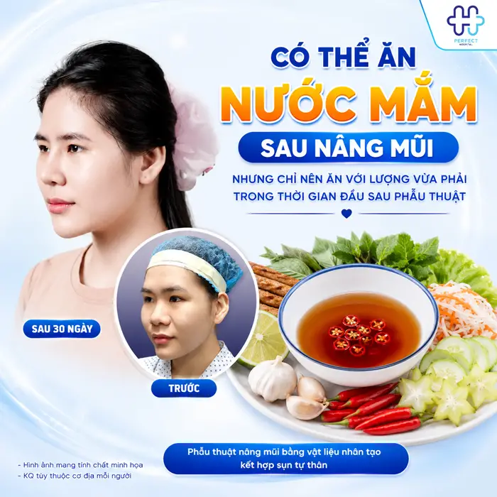 Nâng Mũi Có Được Ăn Nước Mắm Không? Khi Nào Có Thể Sử Dụng
