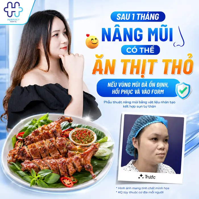 Nâng Mũi Ăn Thịt Thỏ Được Không? Tại Sao Bác Sĩ Khuyên Nên Kiêng?