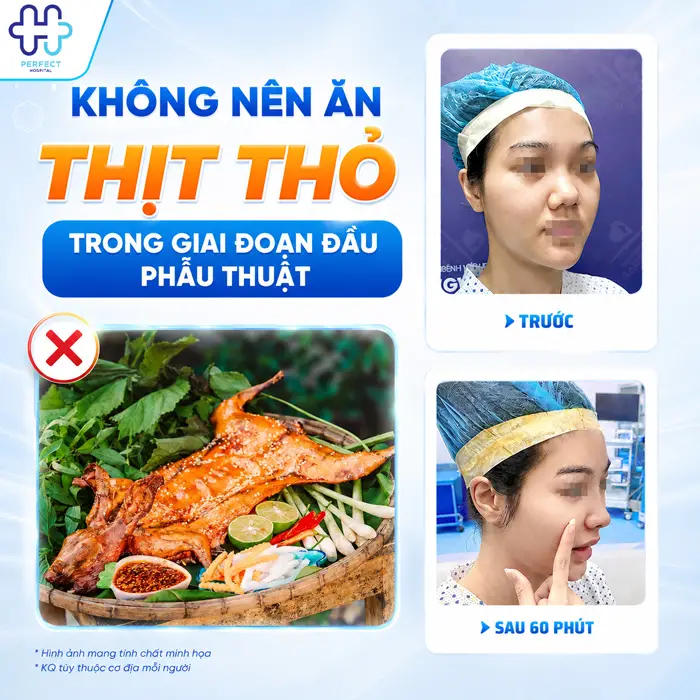 Nâng Mũi Ăn Thịt Thỏ Được Không? Tại Sao Bác Sĩ Khuyên Nên Kiêng?