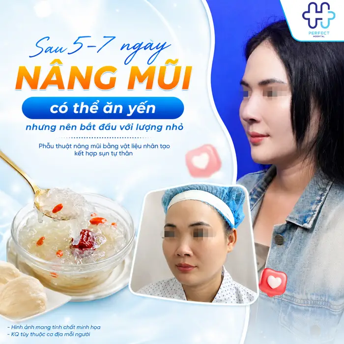 Nâng Mũi Ăn Yến Được Không? Cần Lưu Ý Gì Khi Sử Dụng