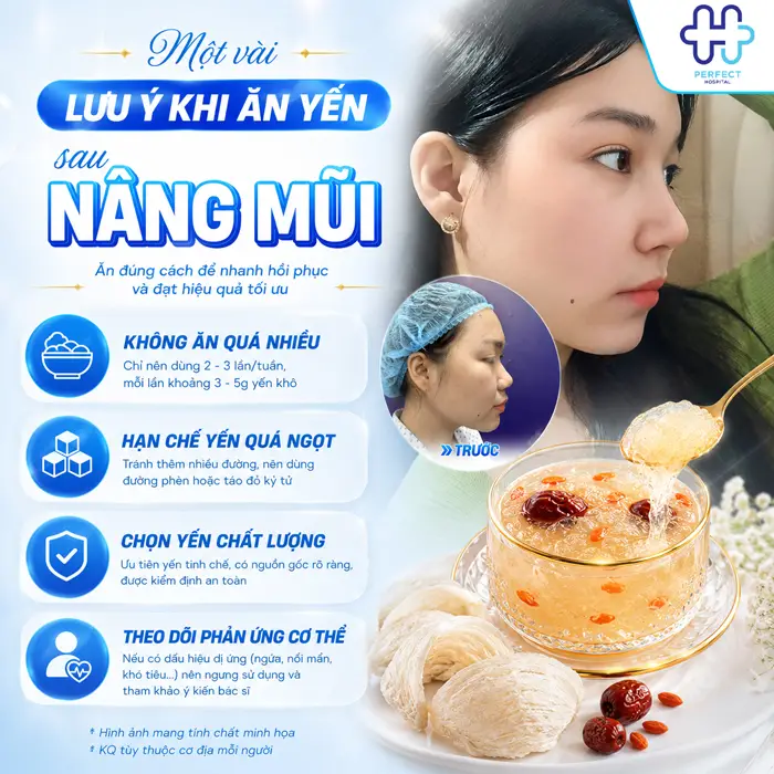 Nâng Mũi Ăn Yến Được Không? Cần Lưu Ý Gì Khi Sử Dụng