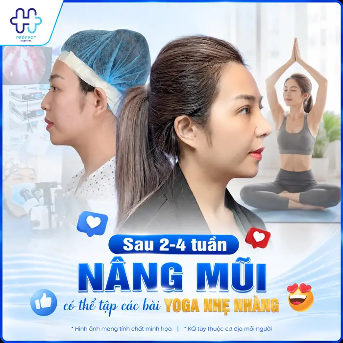 Nâng Mũi Bao Lâu Được Tập Yoga An Toàn, Không Ảnh Hưởng Dáng Mũi?