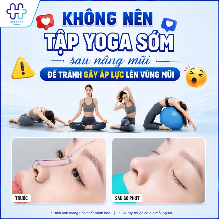 Nâng Mũi Bao Lâu Được Tập Yoga An Toàn, Không Ảnh Hưởng Dáng Mũi?