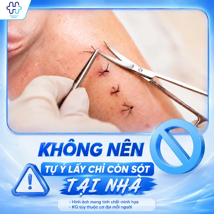 Nâng Mũi Bị Cắt Sót Chỉ Có Sao Không? Cách Xử Lý An Toàn