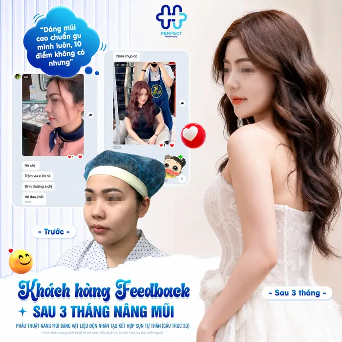 Nâng Mũi Cấu Trúc Và Bán Cấu Trúc Khác Nhau Ở Điểm Nào?