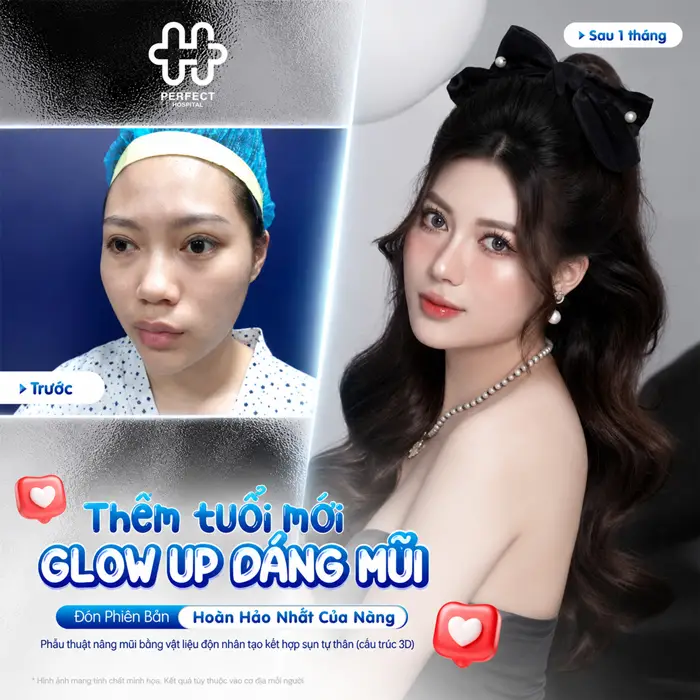 Nâng Mũi Cấu Trúc Và Bán Cấu Trúc Khác Nhau Ở Điểm Nào?